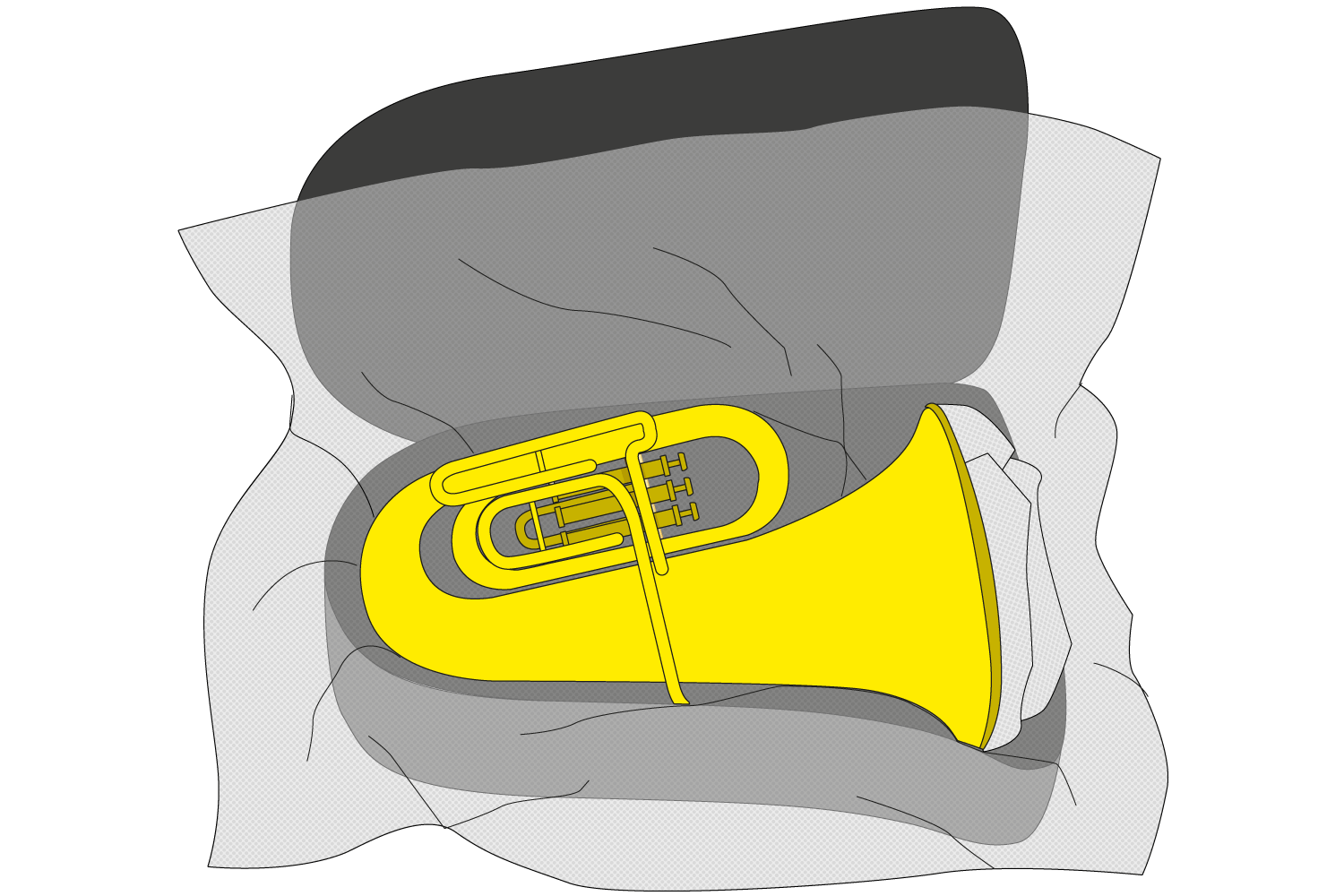 Step 5.1